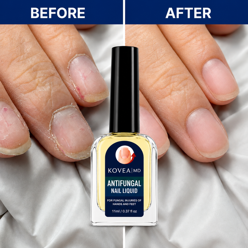 Clear Fungus Nails & Restore Healthy Clear Nails in Just 14 Days!